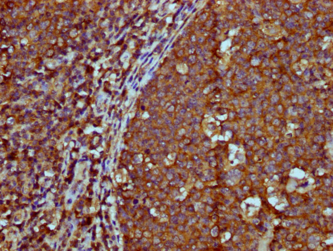 IGHM Antibody in Immunohistochemistry (Paraffin) (IHC (P))