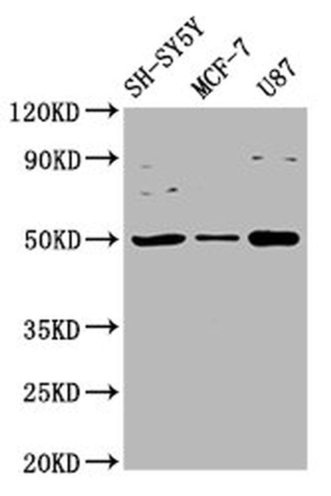 IGHM Antibody in Western Blot (WB)