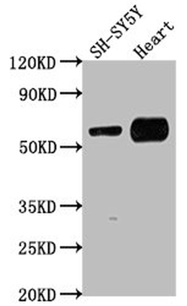 JRK Antibody in Western Blot (WB)