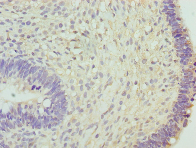 HCE Antibody in Immunohistochemistry (Paraffin) (IHC (P))