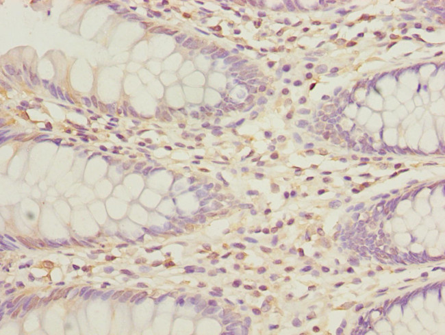 GALNT2 Antibody in Immunohistochemistry (Paraffin) (IHC (P))