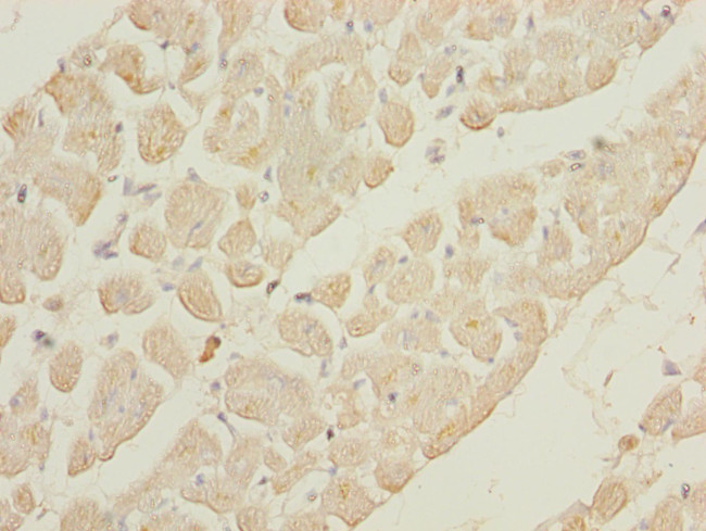 GALNT2 Antibody in Immunohistochemistry (Paraffin) (IHC (P))