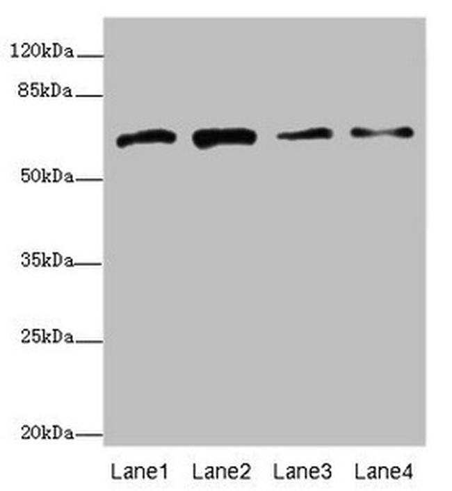 GALNT2 Antibody in Western Blot (WB)