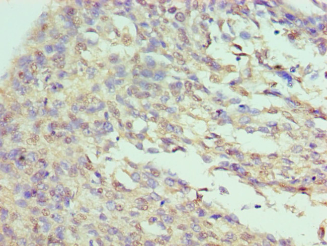 ILF3 Antibody in Immunohistochemistry (Paraffin) (IHC (P))