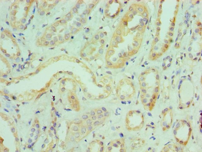 ILF3 Antibody in Immunohistochemistry (Paraffin) (IHC (P))