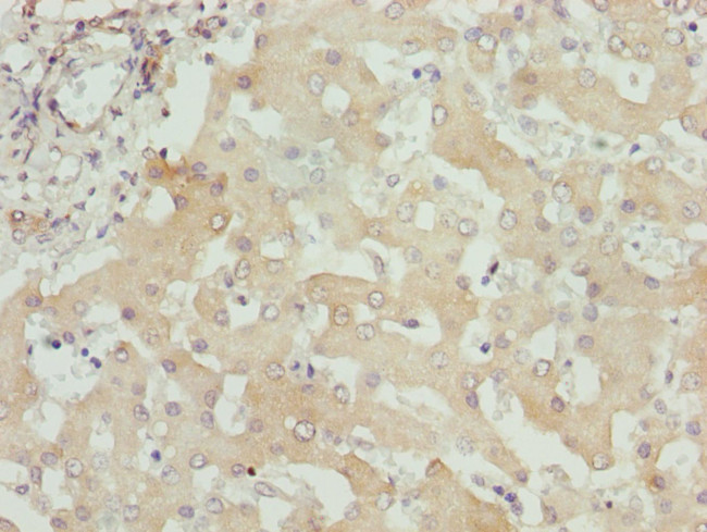 ITPK1 Antibody in Immunohistochemistry (Paraffin) (IHC (P))