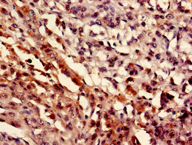 MEF2D Antibody in Immunohistochemistry (Paraffin) (IHC (P))