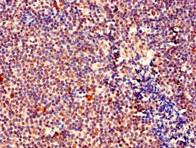 MEF2D Antibody in Immunohistochemistry (Paraffin) (IHC (P))