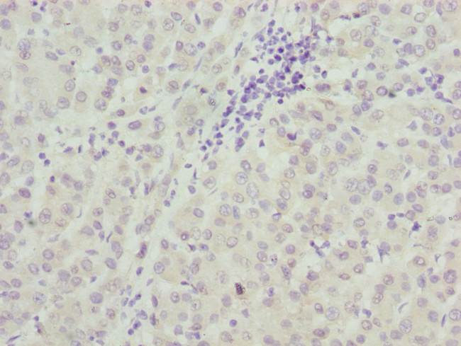 TAF5 Antibody in Immunohistochemistry (Paraffin) (IHC (P))