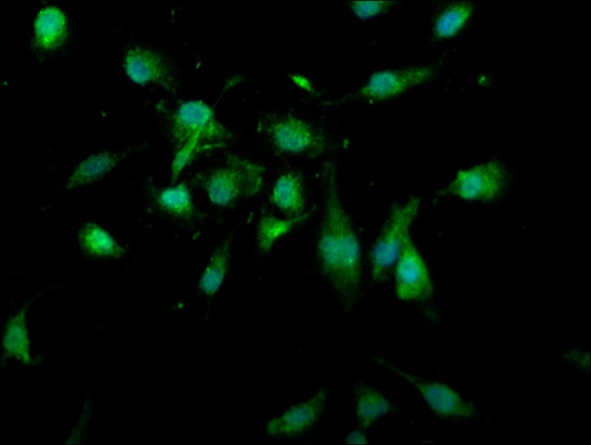 USP4 Antibody in Immunocytochemistry (ICC/IF)