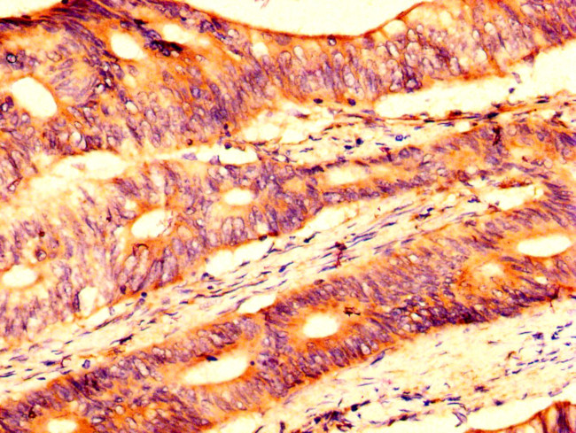 USP4 Antibody in Immunohistochemistry (Paraffin) (IHC (P))