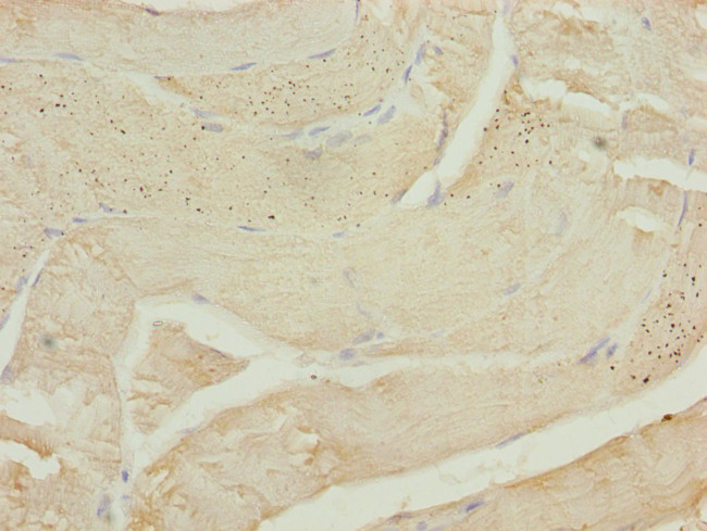 CALCOCO2 Antibody in Immunohistochemistry (Paraffin) (IHC (P))