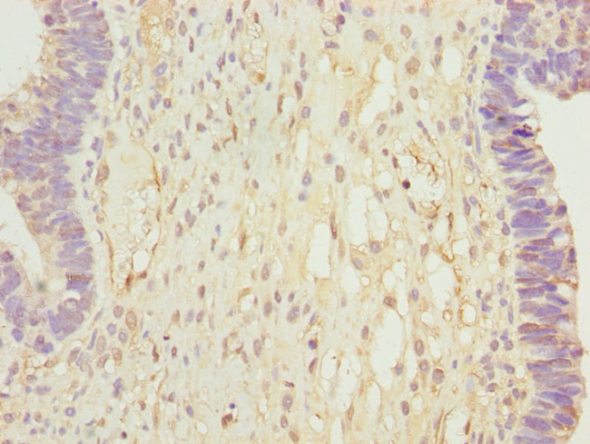 CALCOCO2 Antibody in Immunohistochemistry (Paraffin) (IHC (P))