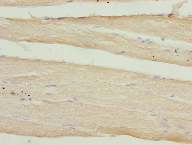 CALCOCO2 Antibody in Immunohistochemistry (Paraffin) (IHC (P))