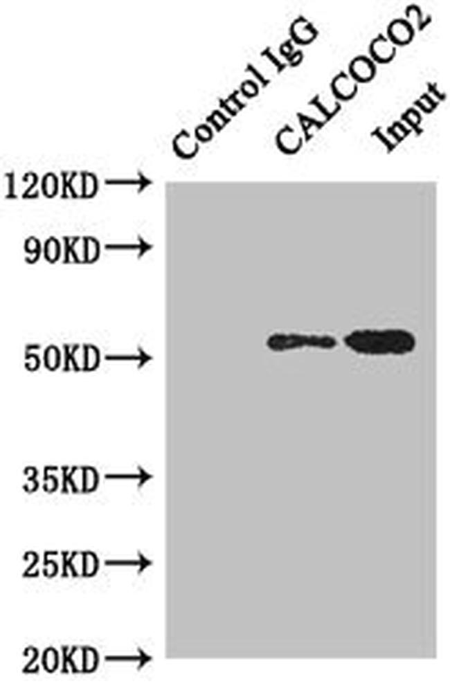 CALCOCO2 Antibody in Western Blot (WB)