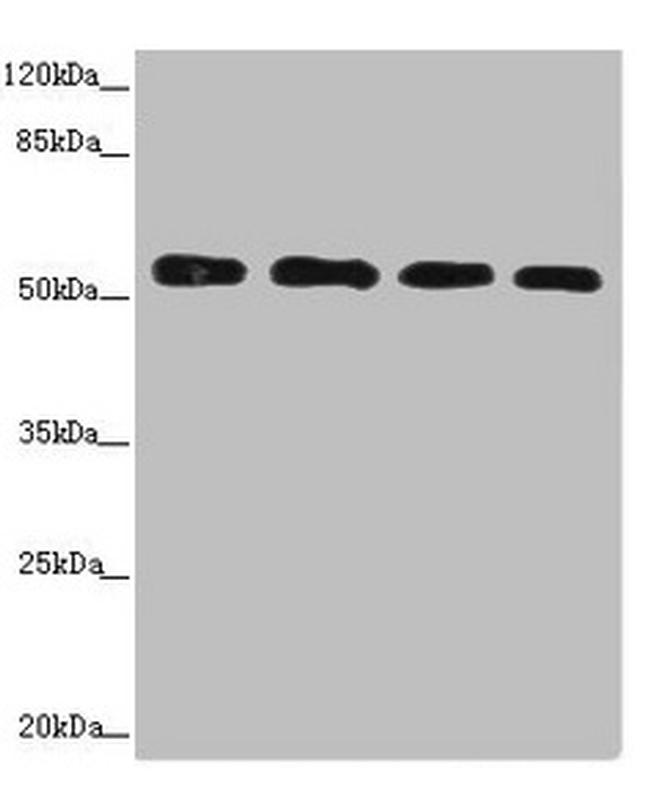 CALCOCO2 Antibody in Western Blot (WB)