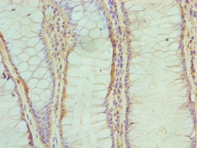 ABH1 Antibody in Immunohistochemistry (Paraffin) (IHC (P))