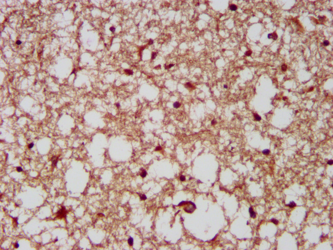 CUX1/Protein CASP Antibody in Immunohistochemistry (Paraffin) (IHC (P))