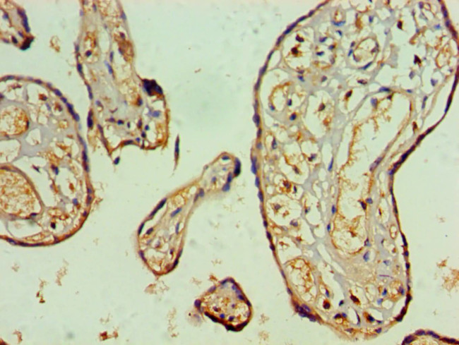 NAB2 Antibody in Immunohistochemistry (Paraffin) (IHC (P))