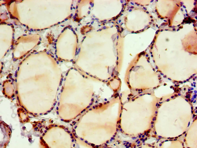 NAB2 Antibody in Immunohistochemistry (Paraffin) (IHC (P))