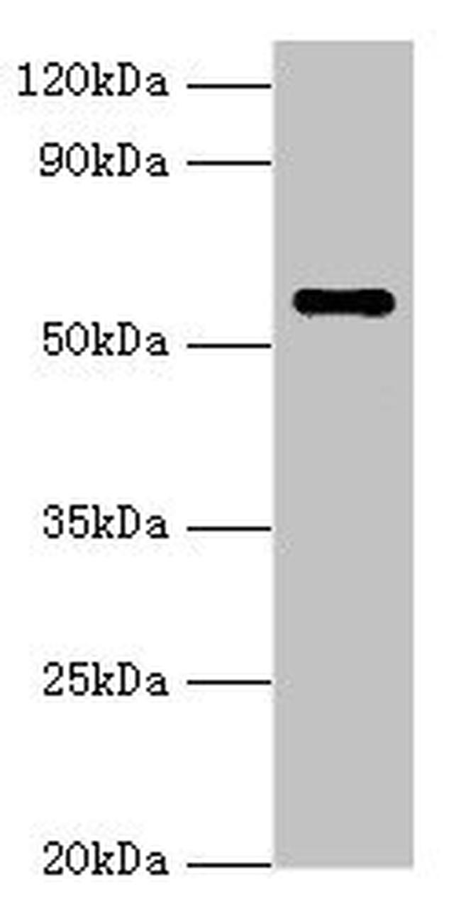 NAB2 Antibody in Western Blot (WB)