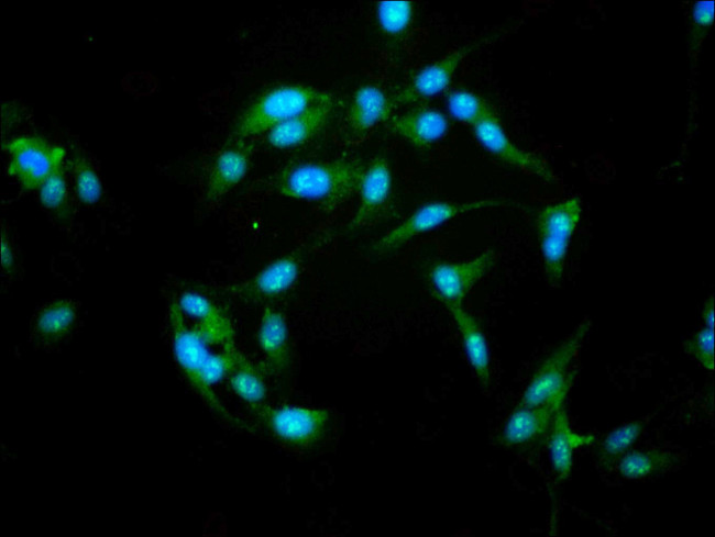 NFATC3 Antibody in Immunocytochemistry (ICC/IF)