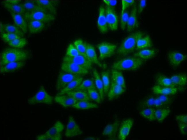 BFSP2 Antibody in Immunocytochemistry (ICC/IF)