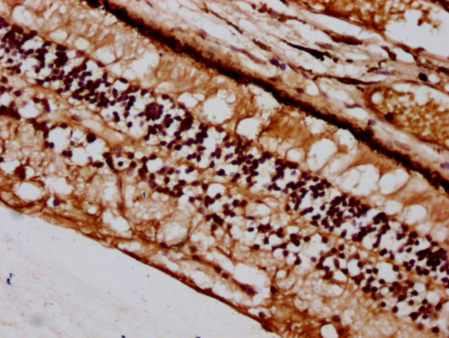 BFSP2 Antibody in Immunohistochemistry (Paraffin) (IHC (P))