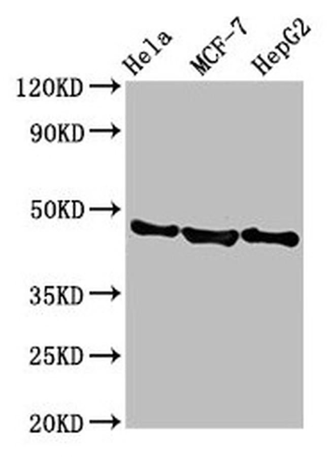 BFSP2 Antibody in Western Blot (WB)