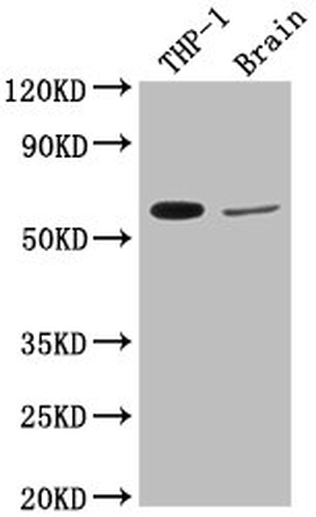 COL9A2 Antibody in Western Blot (WB)