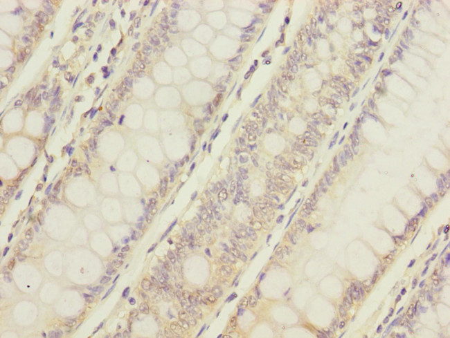 C12orf30 Antibody in Immunohistochemistry (Paraffin) (IHC (P))