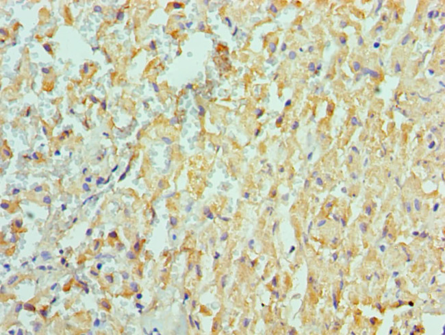 ADAM9 Antibody in Immunohistochemistry (Paraffin) (IHC (P))