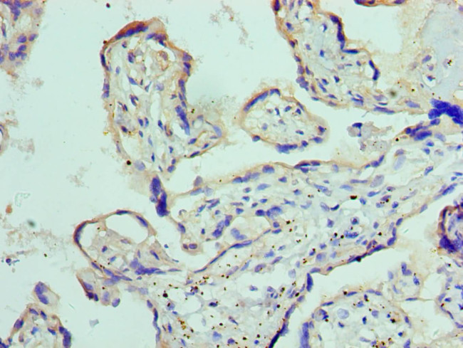 ADAM9 Antibody in Immunohistochemistry (Paraffin) (IHC (P))