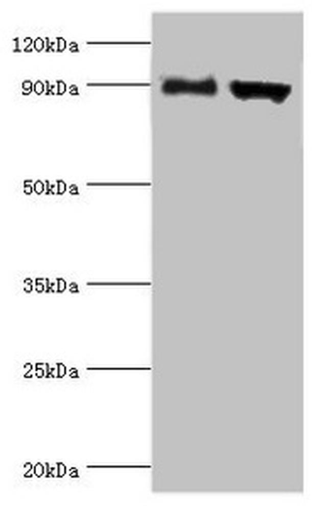 ADAM9 Antibody in Western Blot (WB)