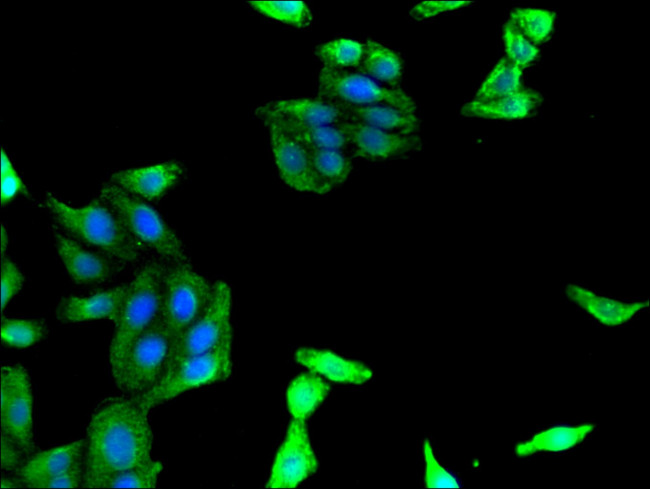 MAdCAM-1 Antibody in Immunocytochemistry (ICC/IF)