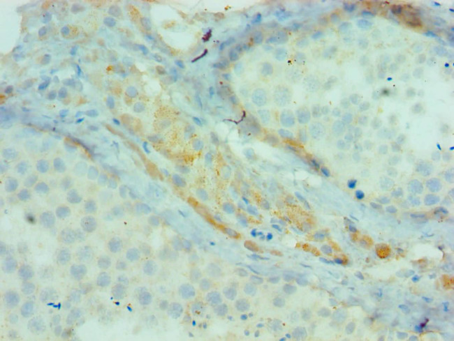 cIAP1 Antibody in Immunohistochemistry (Paraffin) (IHC (P))