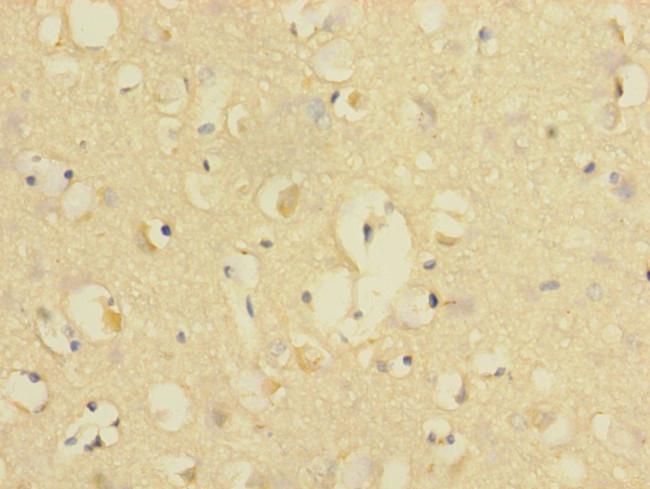 CD226 (DNAM-1) Antibody in Immunohistochemistry (Paraffin) (IHC (P))