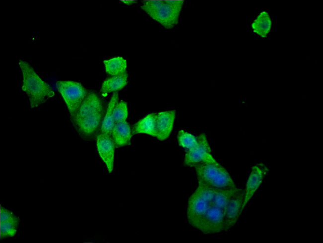 ETFDH Antibody in Immunocytochemistry (ICC/IF)