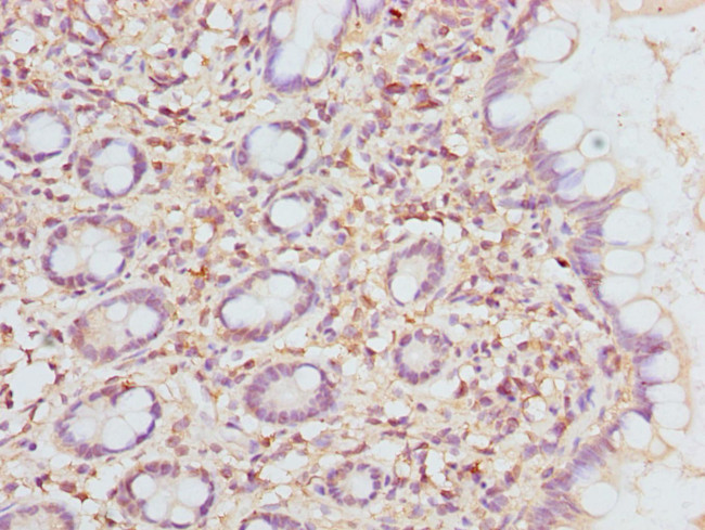 ETFDH Antibody in Immunohistochemistry (Paraffin) (IHC (P))