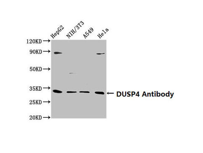 MKP2 Antibody in Western Blot (WB)