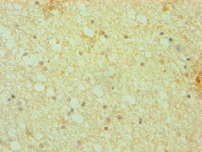 Dynactin 1 Antibody in Immunohistochemistry (Paraffin) (IHC (P))