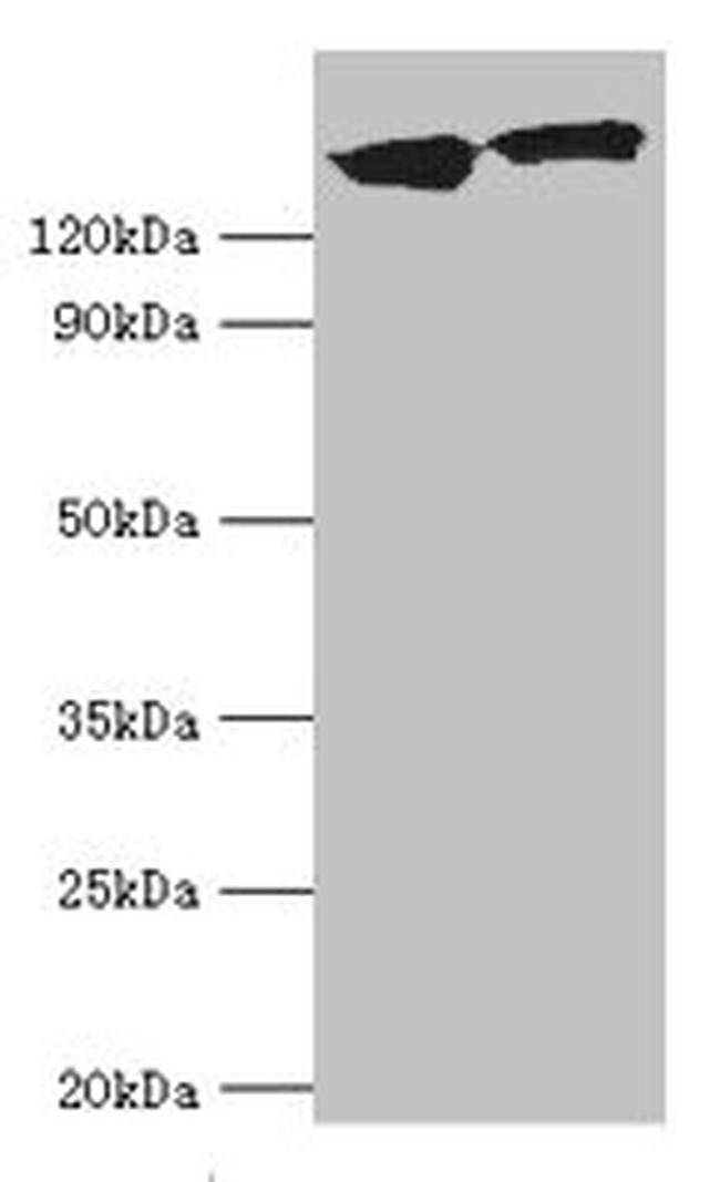 Dynactin 1 Antibody in Western Blot (WB)