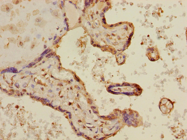 MAPKAPK3 Antibody in Immunohistochemistry (Paraffin) (IHC (P))