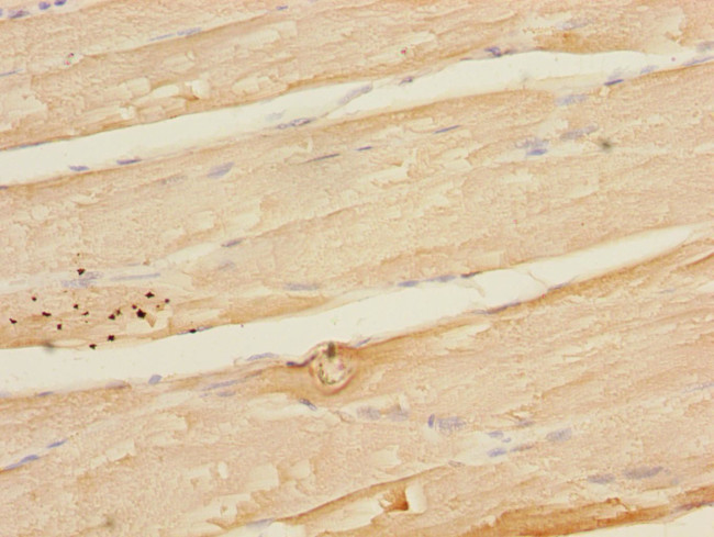 MAPKAPK3 Antibody in Immunohistochemistry (Paraffin) (IHC (P))