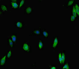 IKAROS Antibody in Immunocytochemistry (ICC/IF)