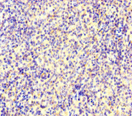 IKAROS Antibody in Immunohistochemistry (Paraffin) (IHC (P))