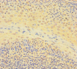 IKAROS Antibody in Immunohistochemistry (Paraffin) (IHC (P))