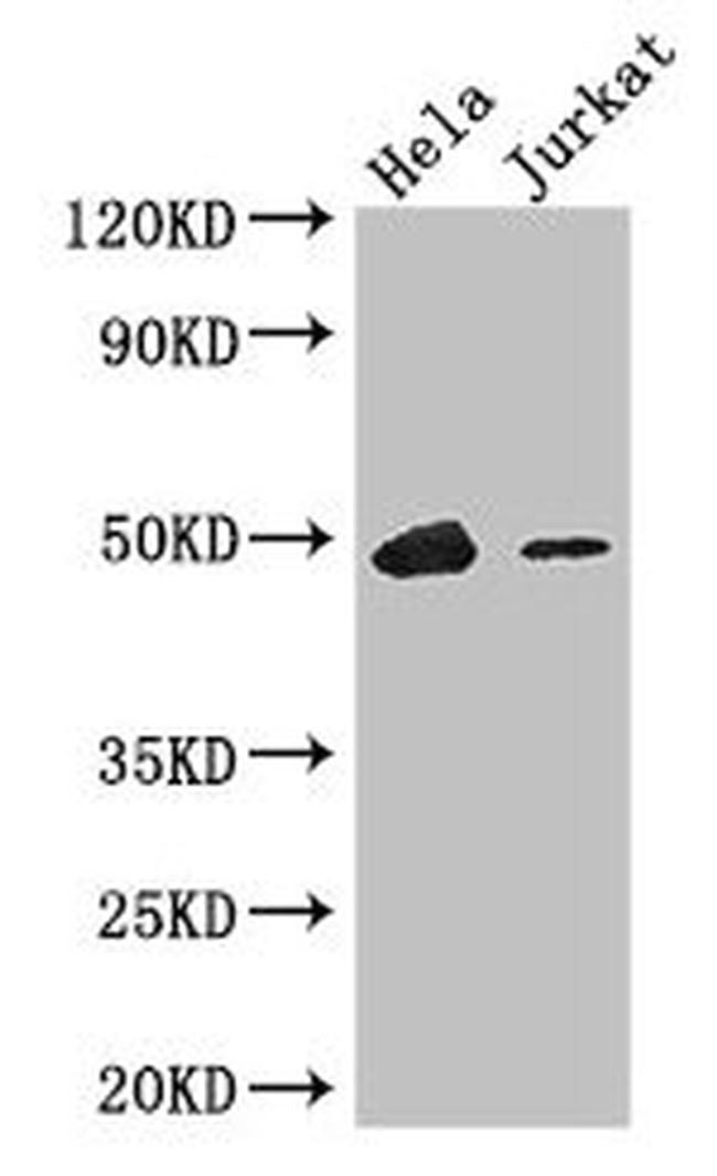 IKAROS Antibody in Western Blot (WB)