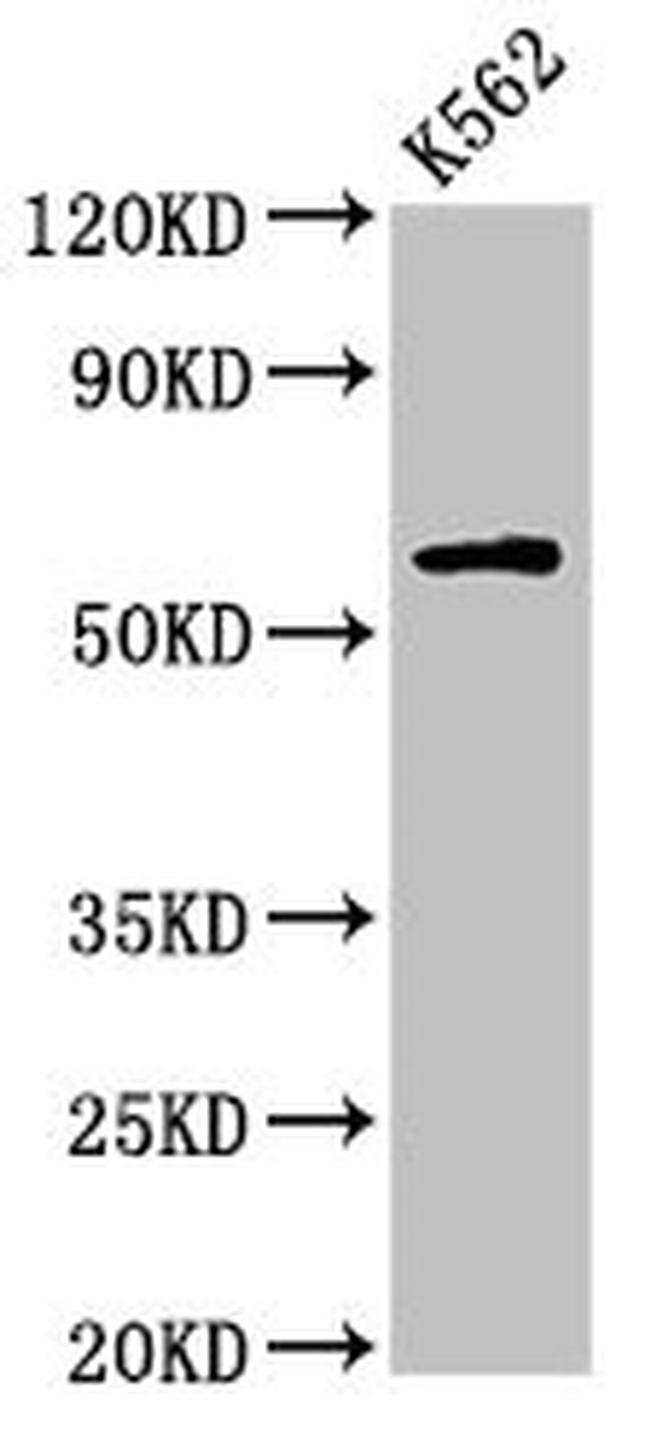 IL10RA Antibody in Western Blot (WB)