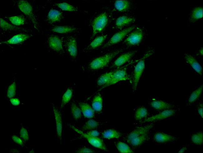 RAB3GAP1 Antibody in Immunocytochemistry (ICC/IF)